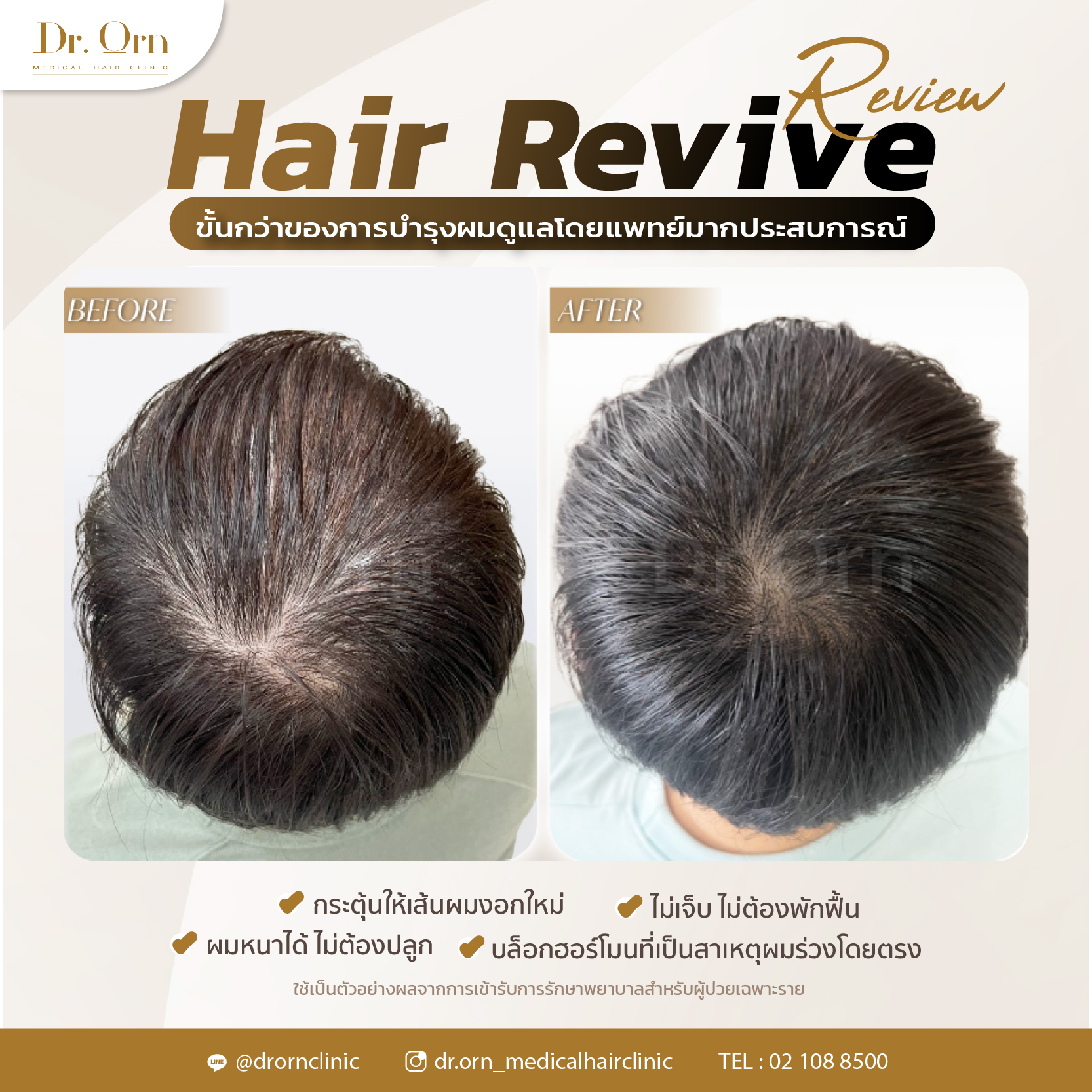 รีวิว hair revive