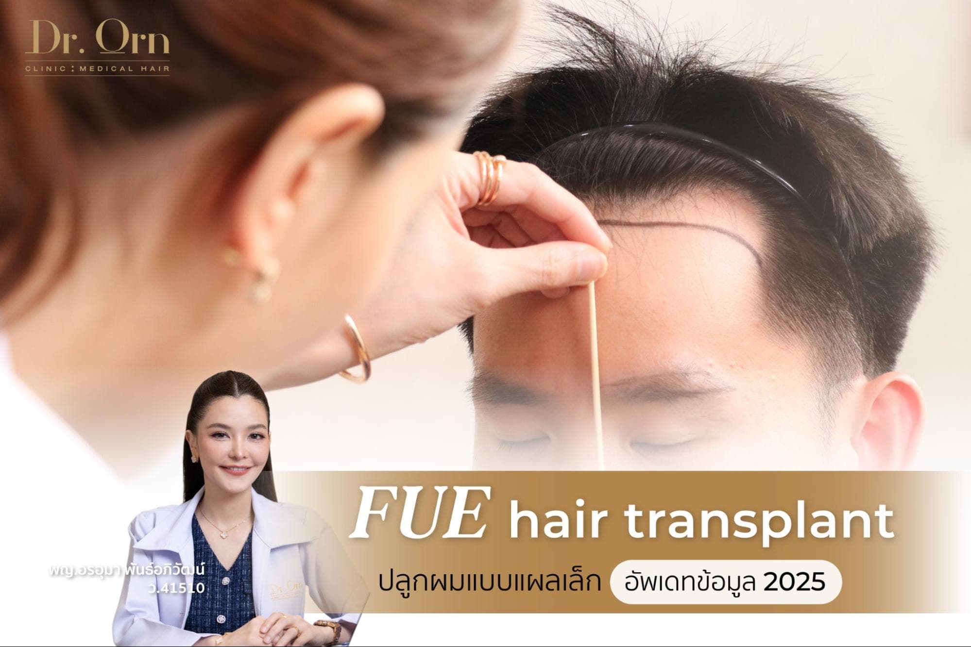 ปลูกผม FUE ปลูกผมแบบไม่มีรอยแผลยาว เทคนิคยอดฮิต 2025