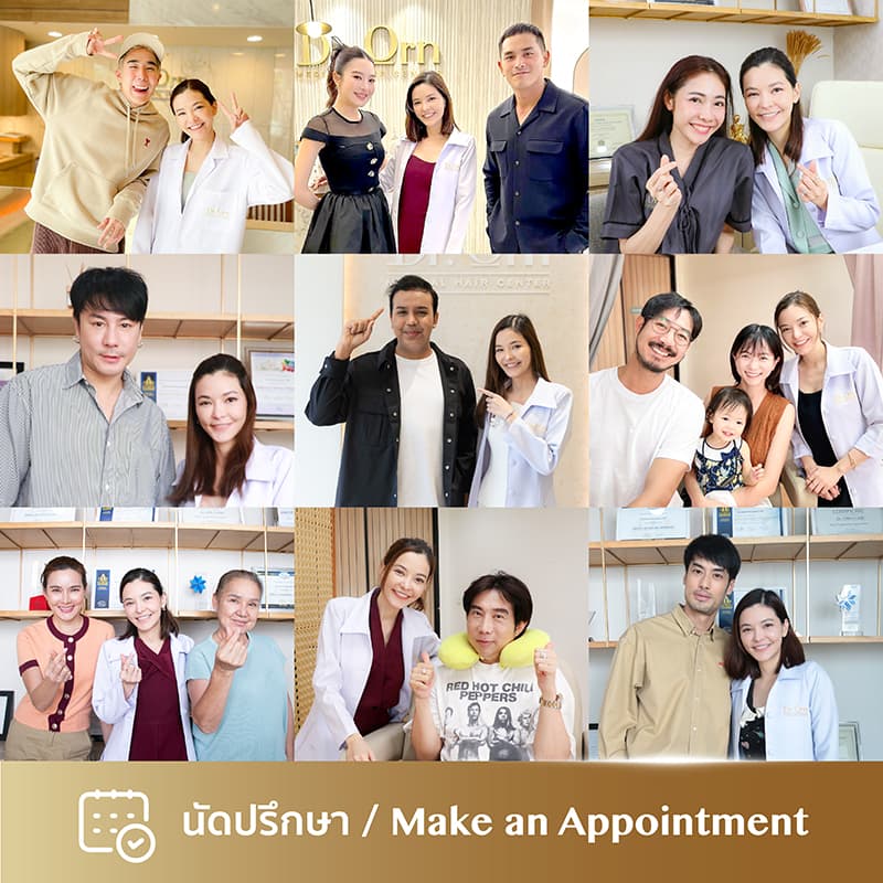 fue ปลูกผม