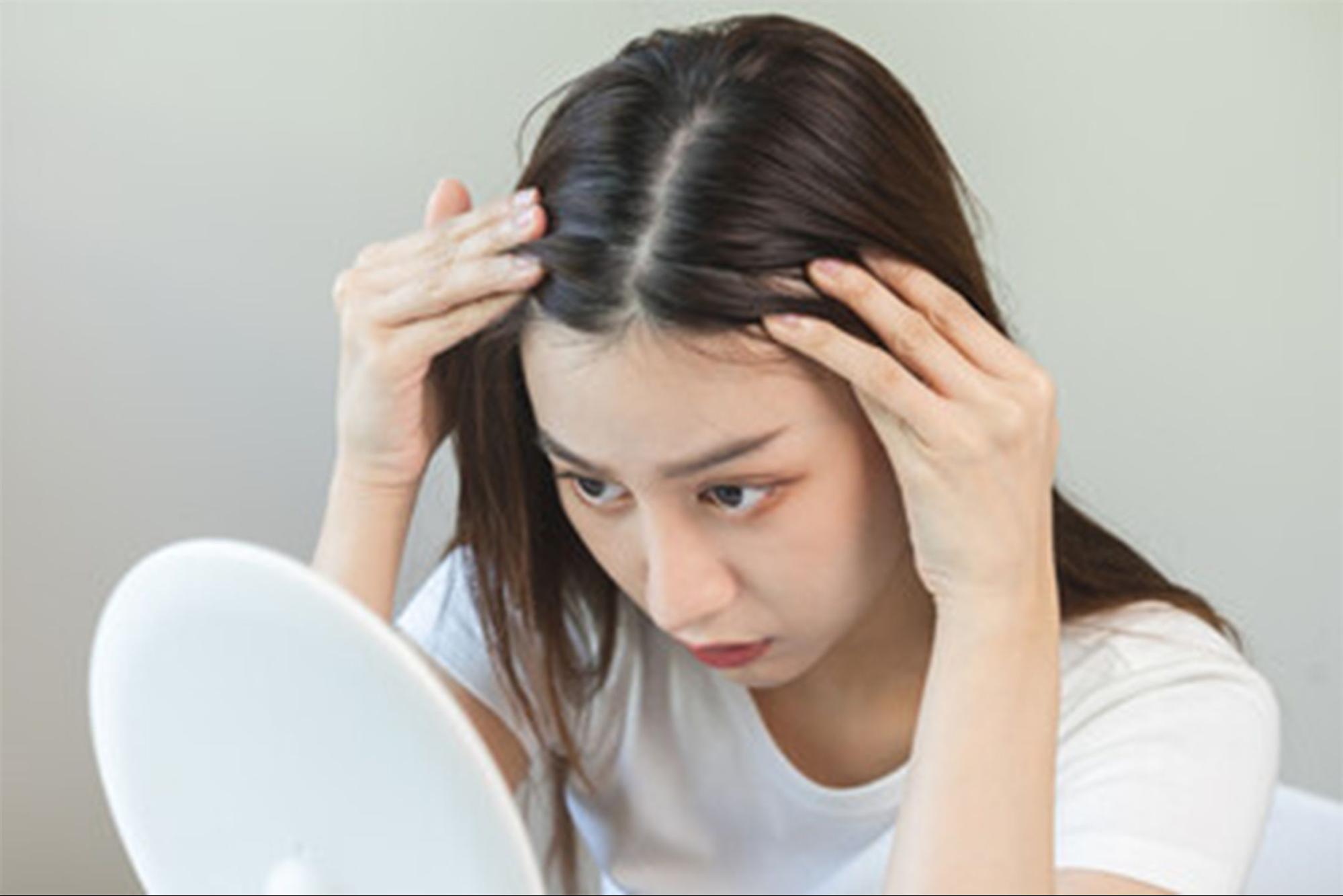 ผมร่วงกินอะไรดี