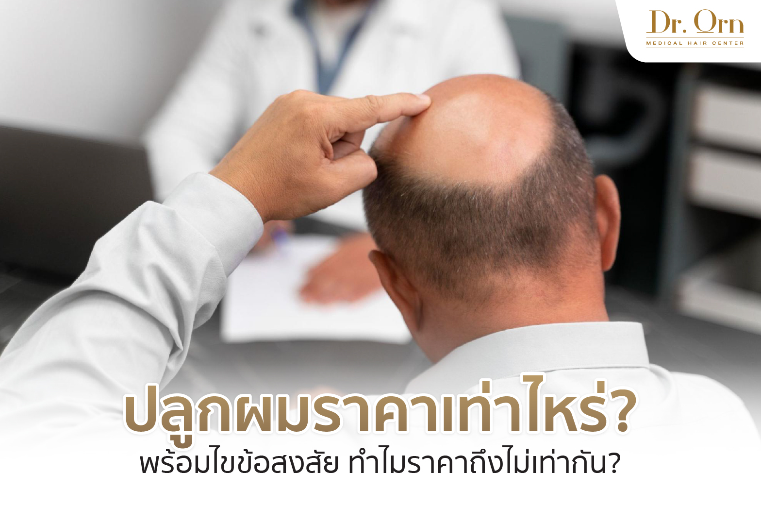 ปลูกผมราคาเท่าไหร่? พร้อมไขข้อสงสัย ทำไมราคาถึงไม่เท่ากัน?