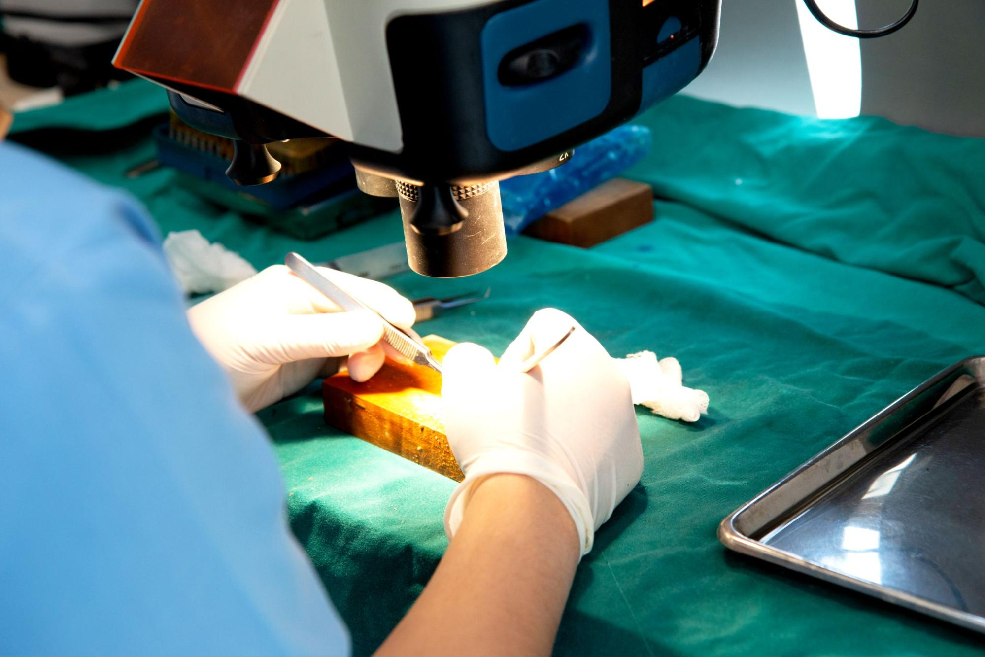 การปลูกผม วิธีแก้ผมร่วง