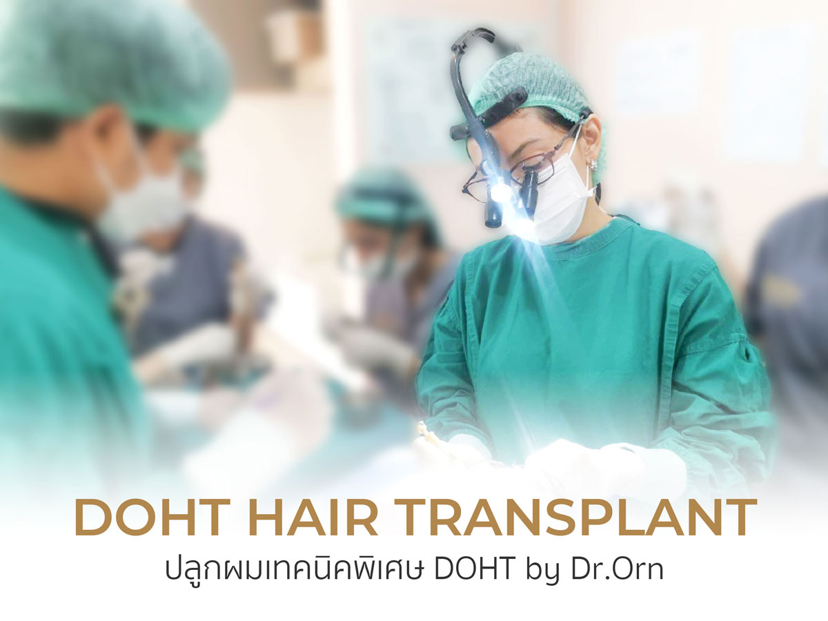 Doht Hair Transplant ปลูกผมเทคนิคพิเศษ DOHT by Dr.Orn